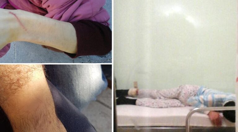 Πέθανε ένα από τα άτομα με αυτισμό που έδεναν στο Λοιμωδών