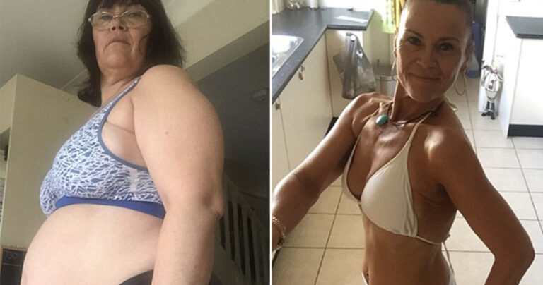 Γιαγιά από την Αυστραλία  έχασε 31 κιλά σε μόλις 12 εβδομάδες χωρίς γυμναστική
