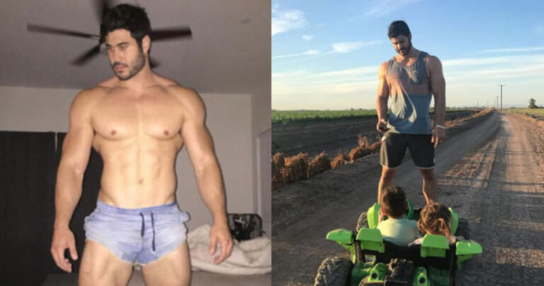 Αυτός ο άνδρας είναι γνωστός ως άνδρας-δέντρο λόγω της σωματικής του διάπλασης