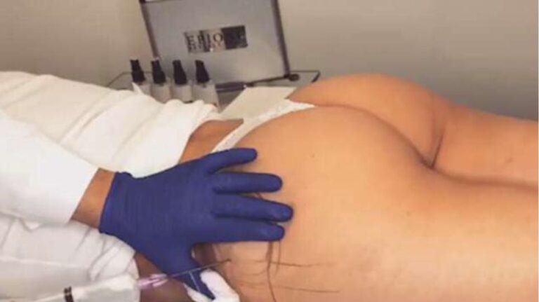 Έτσι γεμίζουν τα οπίσθια και γίνονται σφριγηλά μέσα σε λίγα λεπτά