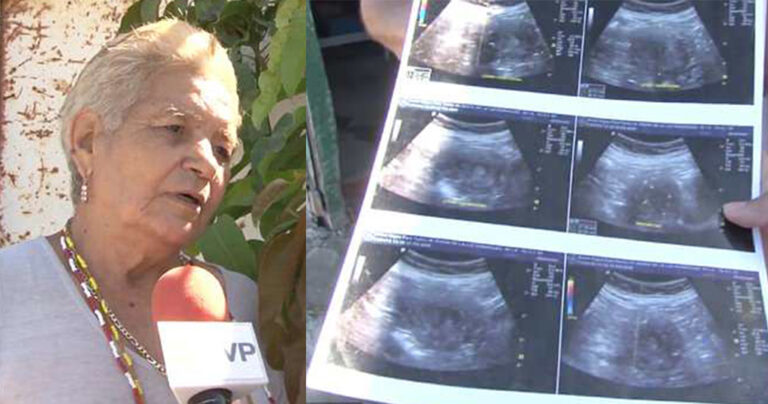 70χρονη ισχυρίζεται ότι είναι έγκυος και περιμένει κοpιτσάκι