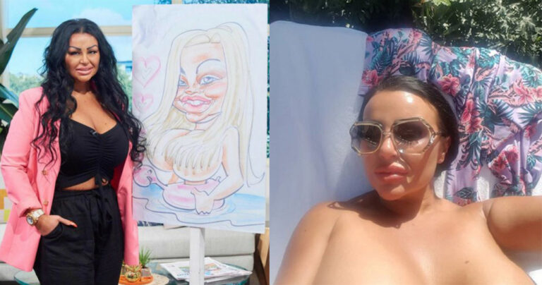 Γυναίκα εθισμένη στις πλαστικές έκανε τις ρώγες να μοιάζουν με καρδίες