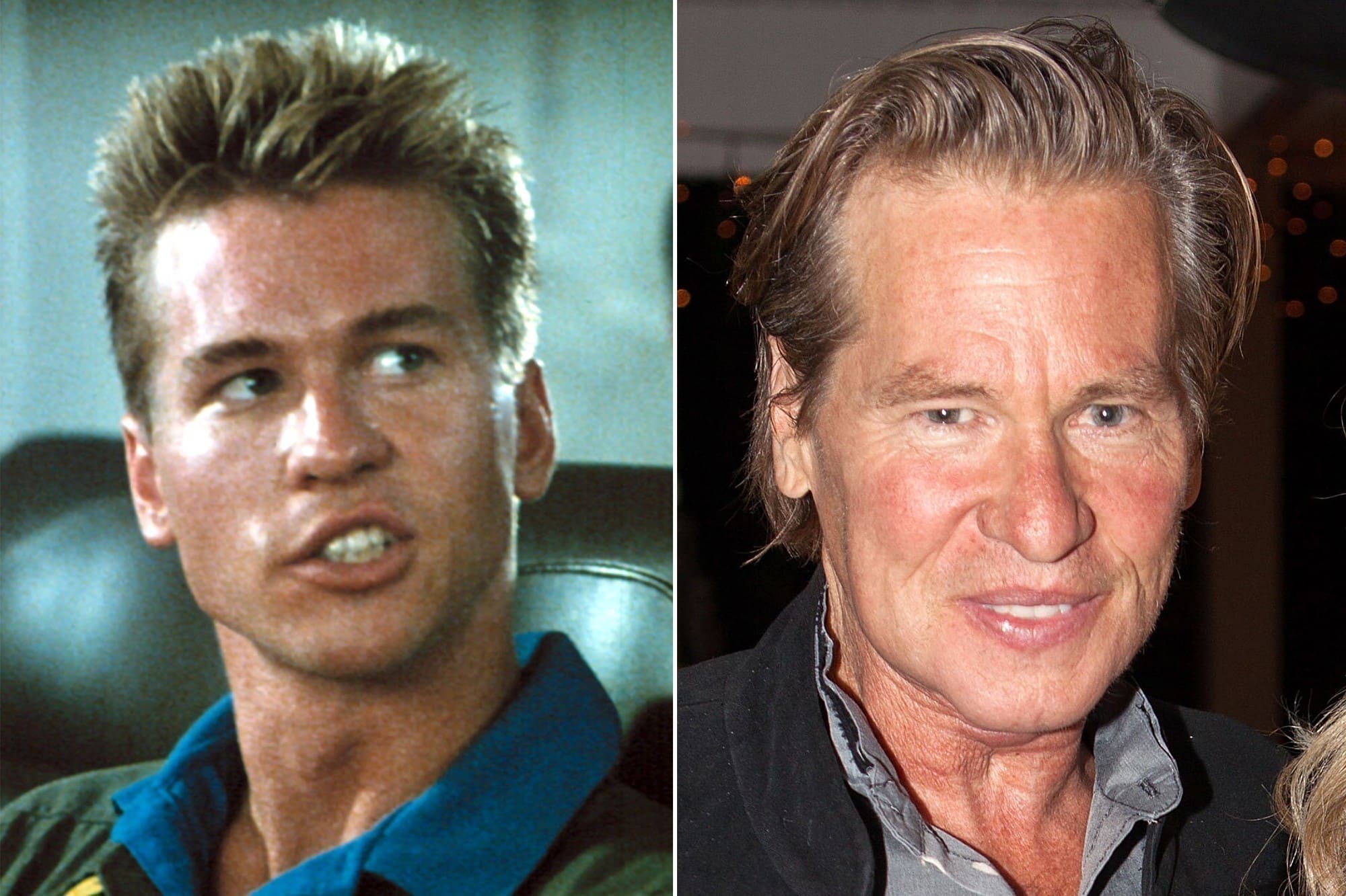 170524 before after val kilmer