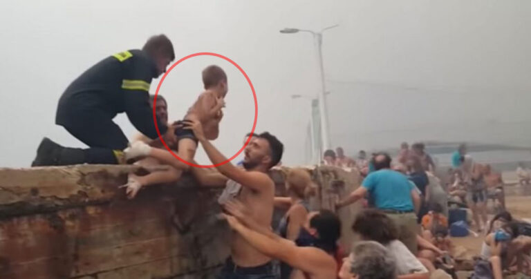 Φωτιά στο Μάτι: Πήρε εξιτήριο το τελευταίο παιδί που νοσηλευόταν με εγκαύματα