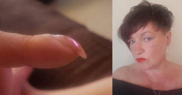53χρονη ανακάλυψε ότι έχει καρκίνο από φωτογραφία των νυχιών της που ανέβασε στο ίντερνετ