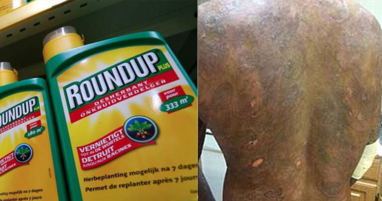 Καταδίκη για τη Monsanto: Πληρώνει αποζημίωση – μαμούθ για εμφάνιση καρκίνου από το Roundup
