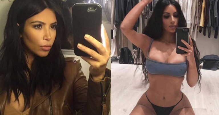 Γιατρός είπε στην Κιμ Καρντάσιαν να σταματήσει τις selfies λόγω τραυματισμού του καρπού της