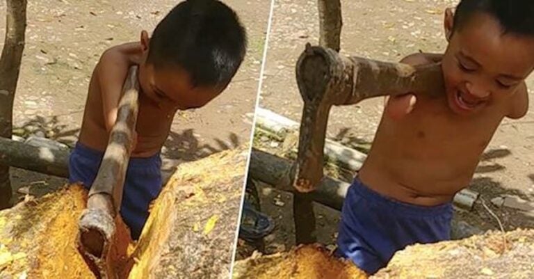 Αγόρι χωρίς χέρια κόβει με τσεκούρι τον κορμό ενός δέντρου