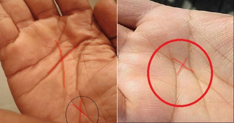 Μήπως ανήκετε στους ελάχιστους που έχουν το γράμμα Χ στις παλάμες τους;