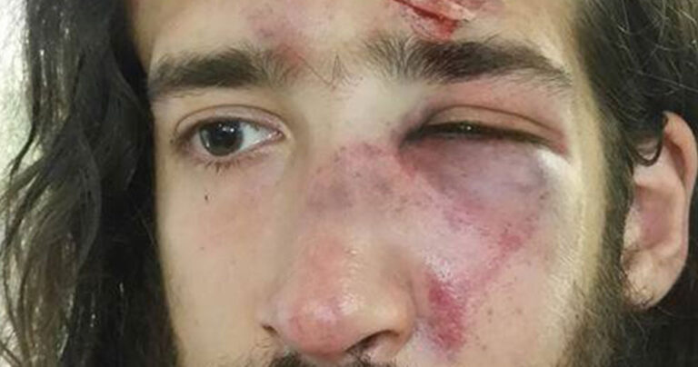 Στελέχος του ΣΥΡΙΖΑ δέχτηκε άγρια επίθεση από Χρυσαυγίτες