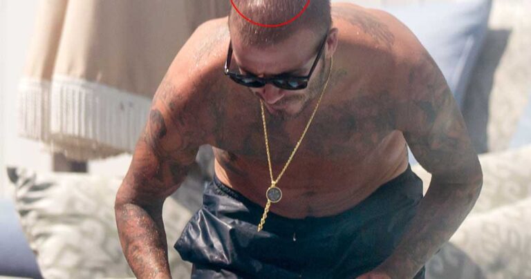 O Ντέιβιντ Μπέκαμ αρχίζει να χάνει τα μαλλιά του και το ίντερνετ ανησυχεί