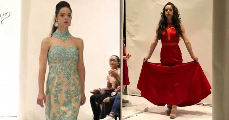 Μοντέλο με σύνδρομο Ντάουν συμμετείχε στην Εβδομάδα Μόδας της Νέας Υόρκης