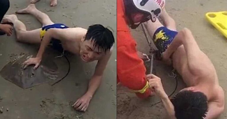 Σάλαχι δάγκωσε τα γεννητικά όργανα ενός άντρα σε παραλία της Κίνας