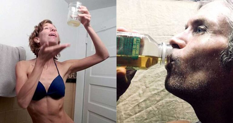 Άνθρωποι πίνουν τα ούρα τους για να χάσουν βάρος και να απαλλαγούν από την ακμή