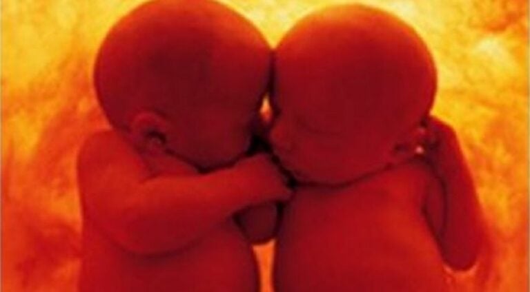 Στη μήτρα μιας μητέρας βρίσκονται δύο μωρά. Το ένα ρωτά το άλλο: «Πιστεύεις στη ζωή μετά τον τοκετό;»