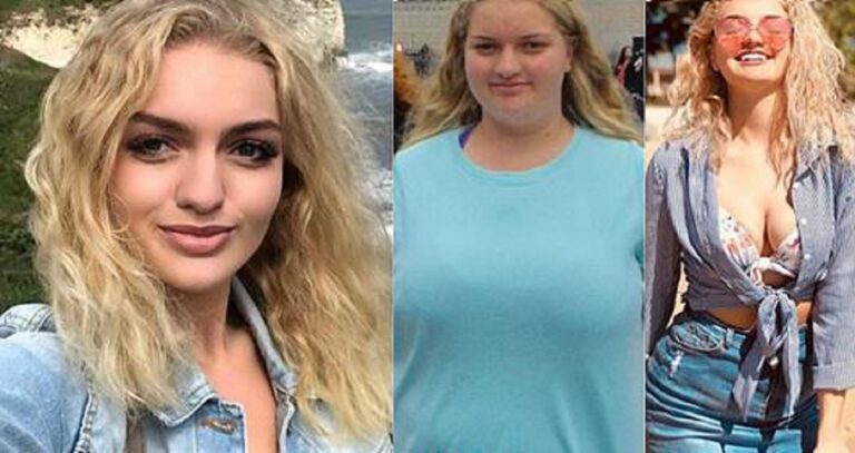 18χρονη θύμα bullying έχασε 63 κιλά για να μπορέσει να φορέσει το επίσημο σχολικό της φόρεμα