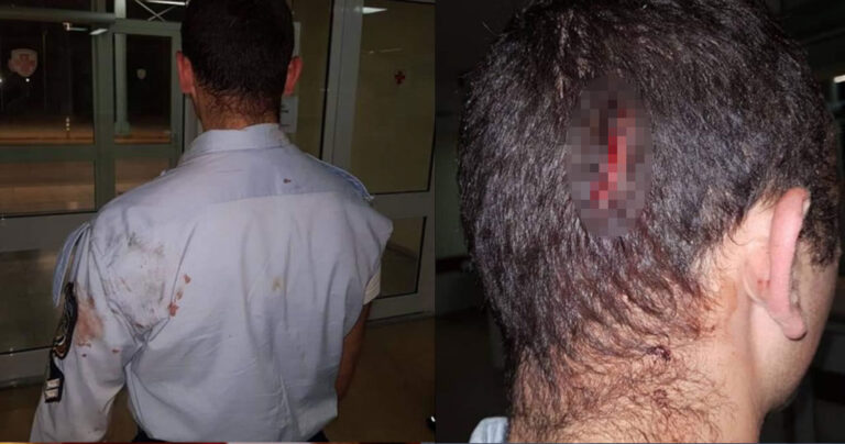 Ρομά έδειραν Έλληνες ασυνομικούς και τα τραύματα πραγματικά σοκάρουν