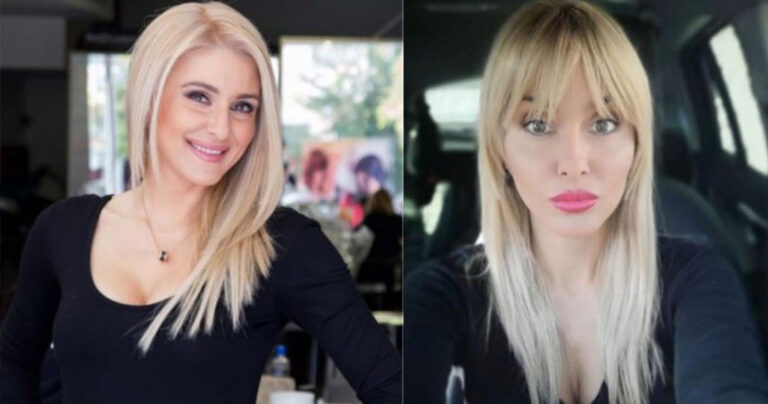 Η Μαρία Φραγκάκη πρίν και μετά τις πλαστικές
