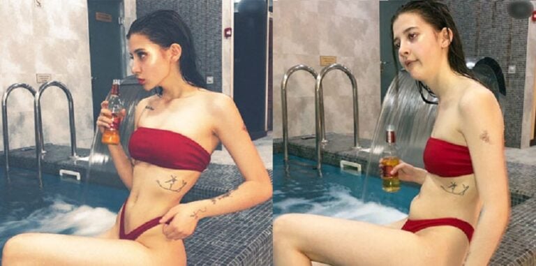 30 φωτογραφίες πριν και μετά που θα δυσκολευτείτε να πιστέψετε ότι πρόκειται για το ίδιο άτομο