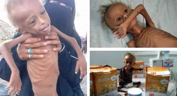 yemen child tw