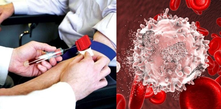Νέο τεστ αίματος βρίσκει τον καρκίνο μέσα σε 10 λεπτά