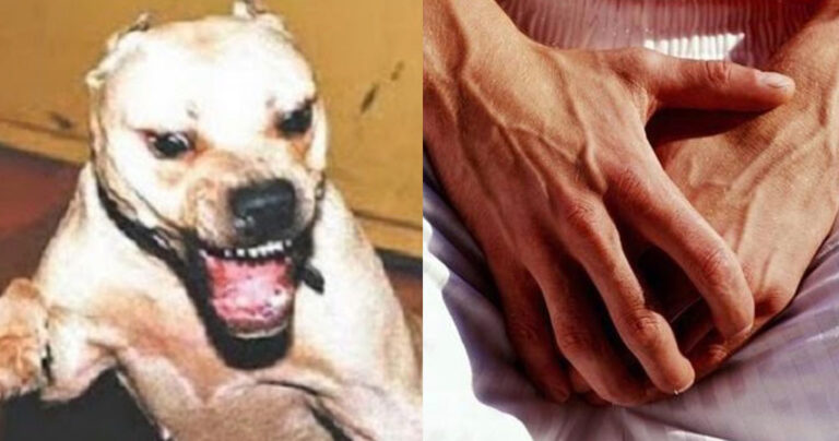 Πιτ μπουλ στα Χανιά δάγκωσε νεαρό στα γεννητικά του όργανα