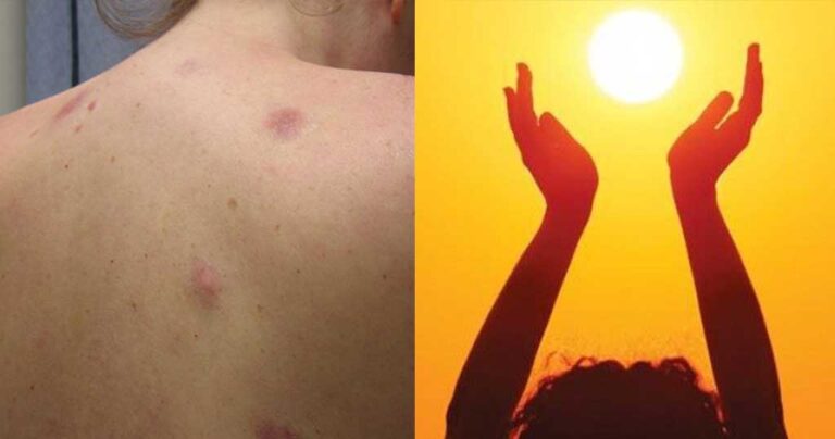 Επτά στους 10 Έλληνες με έλλειψη βιταμίνης D: Πώς θα γεμίσετε τις μπαταρίες