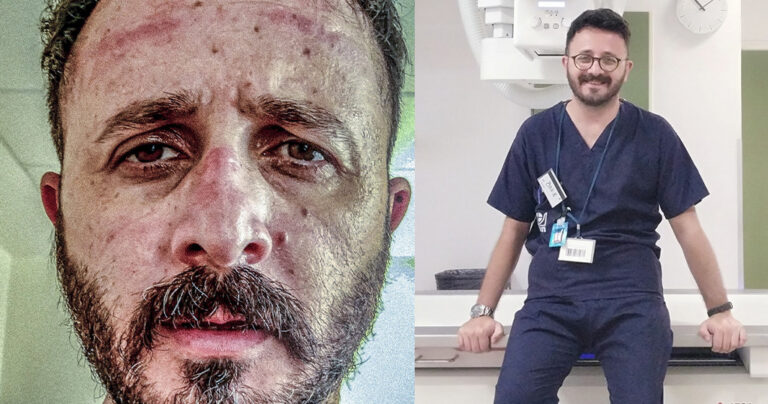 «Εσύ που αρνείσαι τη χρήση μάσκας» – Η συγκλονιστική Ανάρτηση γιατρού από την Κρήτη