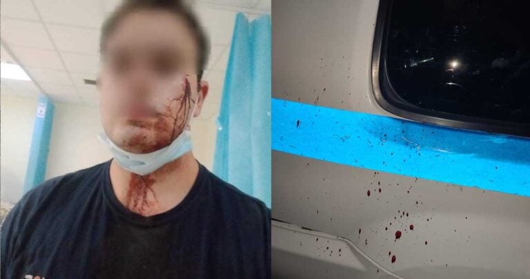 Μενίδι: Άγρια επίθεση Ρομά σε αστυνομικούς της ΕΛ.ΑΣ γιατί τους χάλασαν το γλέντι