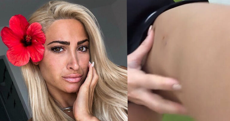 Στο νοσοκομείο η Ιωάννα Τούνη – Της επιτέθηκε σκύλος