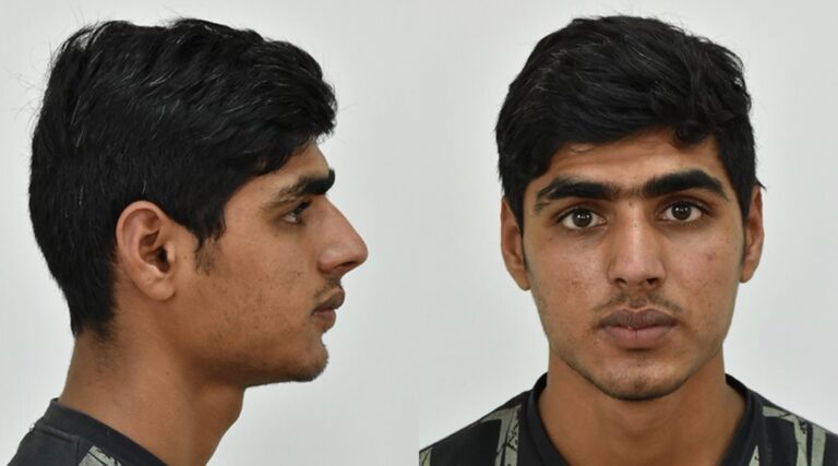 Δείτε τον Πακιστανό βιαστή που ασέλγησε σε 5χρονη στον ιππικό όμιλο στο Κορωπί