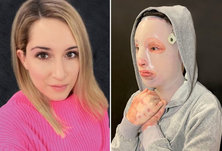 Ιωάννα Παλιοσπύρου: Αποκαλύπτει πώς ένιωσε όταν είδε για πρώτη φορά τον εαυτό της μετά την επίθεση με το βιτριόλι