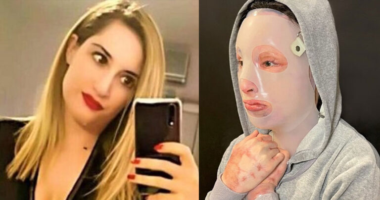 Επίθεση με βιτριόλι: «Δεν δέχομαι καμία συγγνώμη» απαντά η Ιωάννα στην 35χρονη