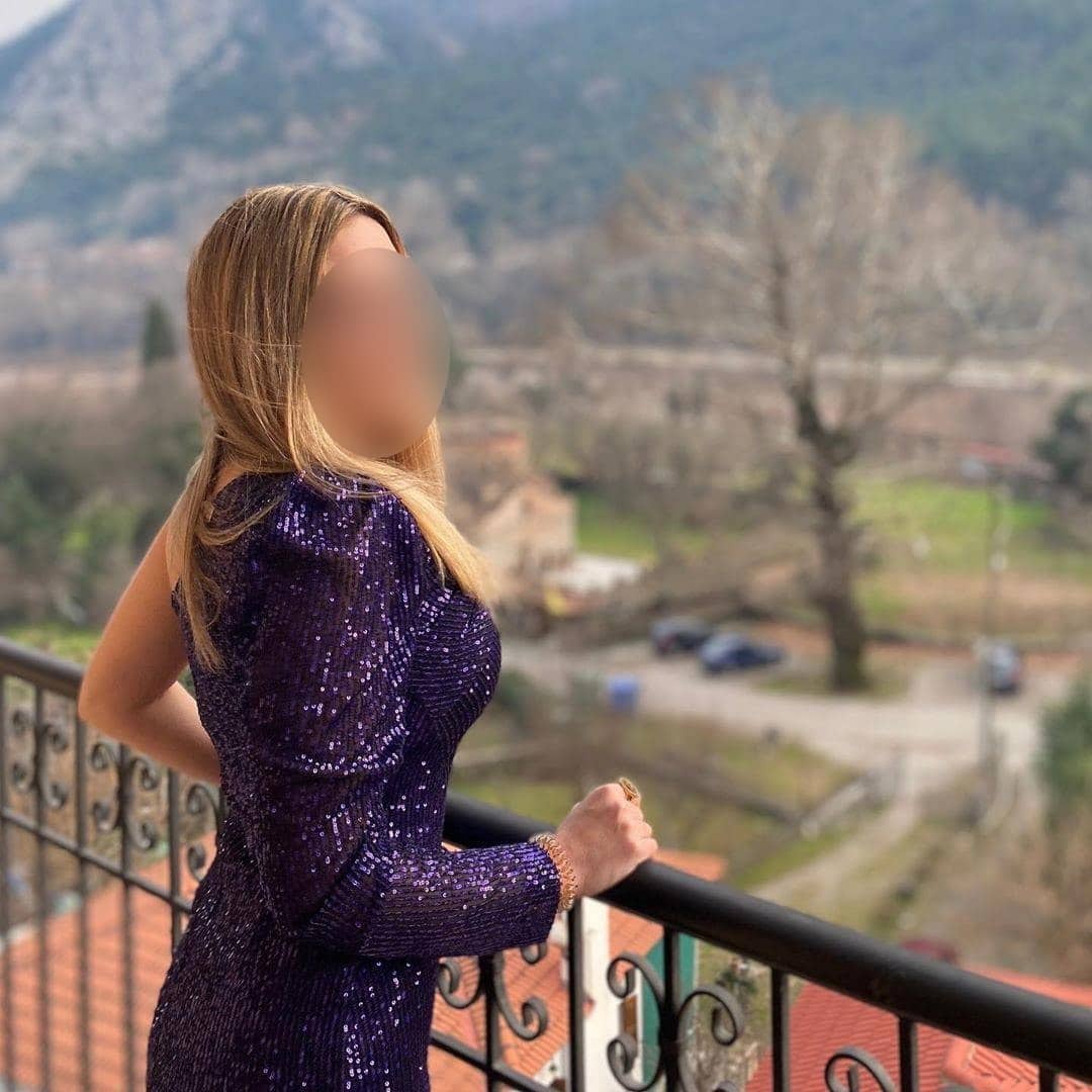 Μια καλλονή η 34χρονη που δέχθηκε επίθεση με βιτριόλι στη Καλλιθέα! Φωτογραφίες 1