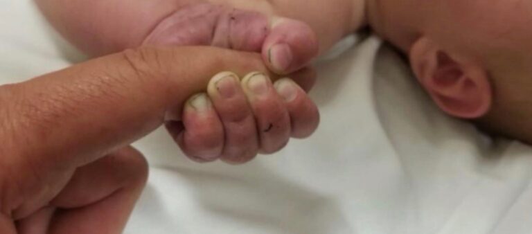 Κορωνοϊός-Σκληρές εικόνες από μαιευτήρια στην Ελλάδα: Ξεγεννούν πρόωρα και ‘αρπάζουν’ τα νεογέννητα από τις μητέρες τους, επειδή τα θεωρούν «ύποπτα περιστατικά»