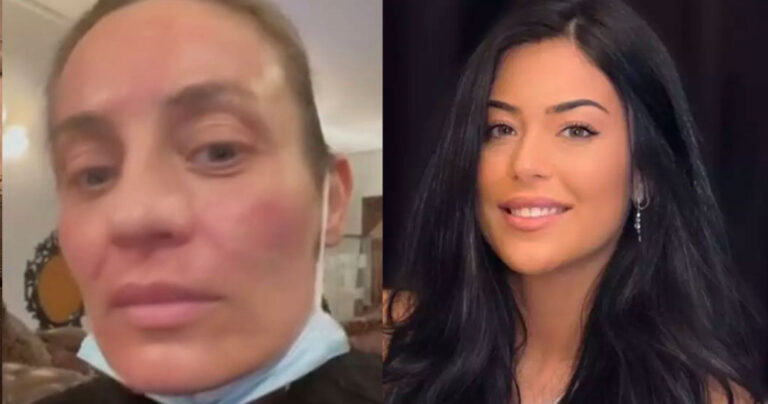 Τρελάθηκε η Μελέτη με την ανάρτηση Λατινοπούλου: «Πάρε τις αντιαισθητικές πανάδες μου»