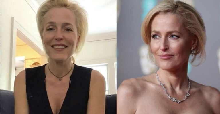 Τζίλιαν Άντερσον: «Τέρμα τα σουτιέν κι ας κρεμάσουν τα στήθη μου μέχρι τον αφαλό!»