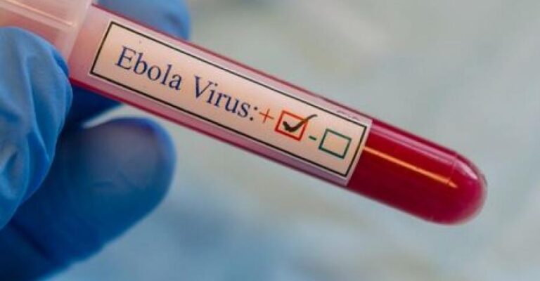 Ακτή Ελεφαντοστού: Εντοπίστηκε κρούσμα του Ebola μετά από σχεδόν 30 χρόνια