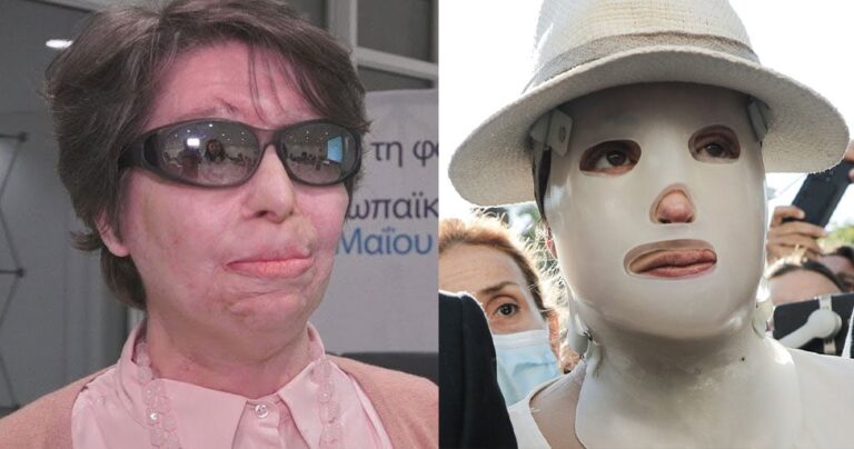 Κωνσταντίνα Κούνεβα: Θυμάται τη δική της οδυνηρή επίθεση με βιτριόλι – Το μήνυμα στην Ιωάννα Παλιοσπύρου