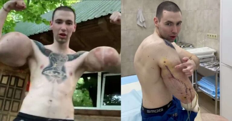 Αθλητής ΜΜΑ επιχείρησε να γίνει «Ποπάι» και τώρα κινδυνεύει να πεθάνει