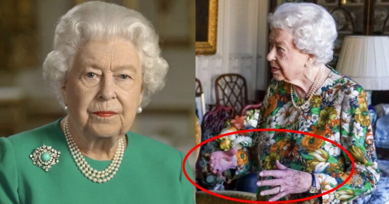 Τα μωβ χέρια της Βασίλισσας Ελισάβετ που πρόδωσαν την ασθένεια της – Τι λένε οι ειδικοί για το σπάνιο σύνδρομο