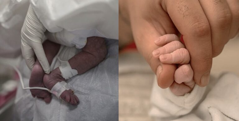 Αεροβαφτίστηκε το 2,5 μηνών βρέφος με κορωνοϊό που νοσηλεύεται διασωληνωμένο στο νοσοκομείο Ρίου