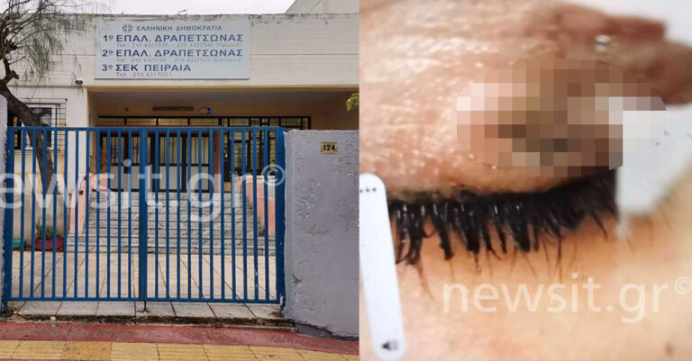 ΕΠΑΛ Δραπετσώνας: Η 16χρονη έσβησε το τσιγάρο στο μάτι συμμαθήτριάς της για… ένα αγόρι