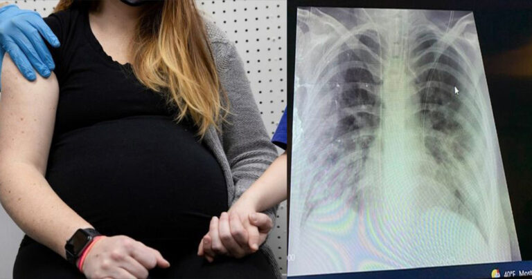 Διασωληνωμένες σε κρίσιμη κατάσταση δύο έγκυες στο Ιπποκράτειο – Σοκάρει ακτινογραφία θώρακα