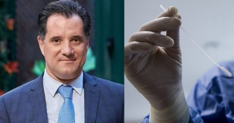 Άδωνις: «Πολύ λογική και δίκαιη η τιμή των 47 ευρώ στα PCR»