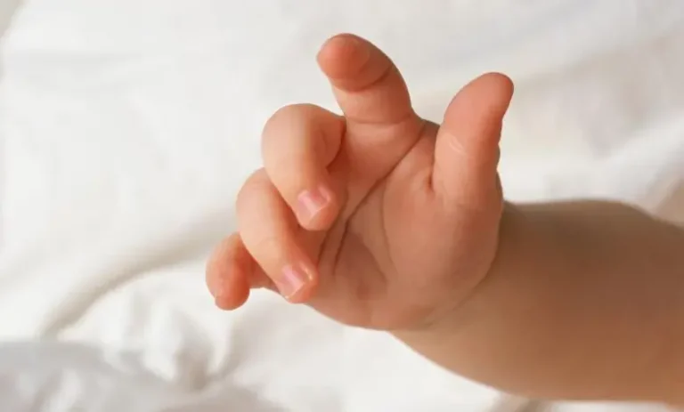 «Το παιδί ήταν παγωμένο όταν ήρθε», λέει ο παιδίατρος για το βρέφος που πέθανε από εγκαύματα