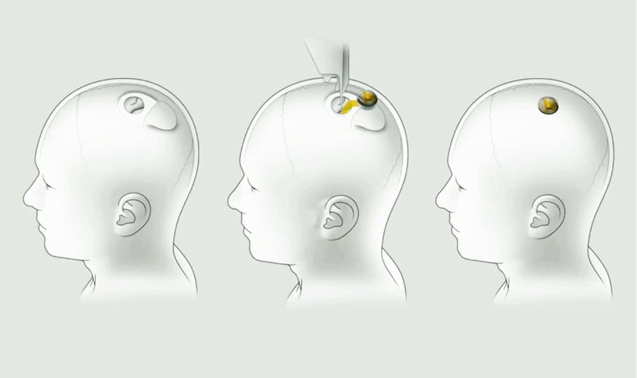 220207173553 neuralink installation 1280x761 1