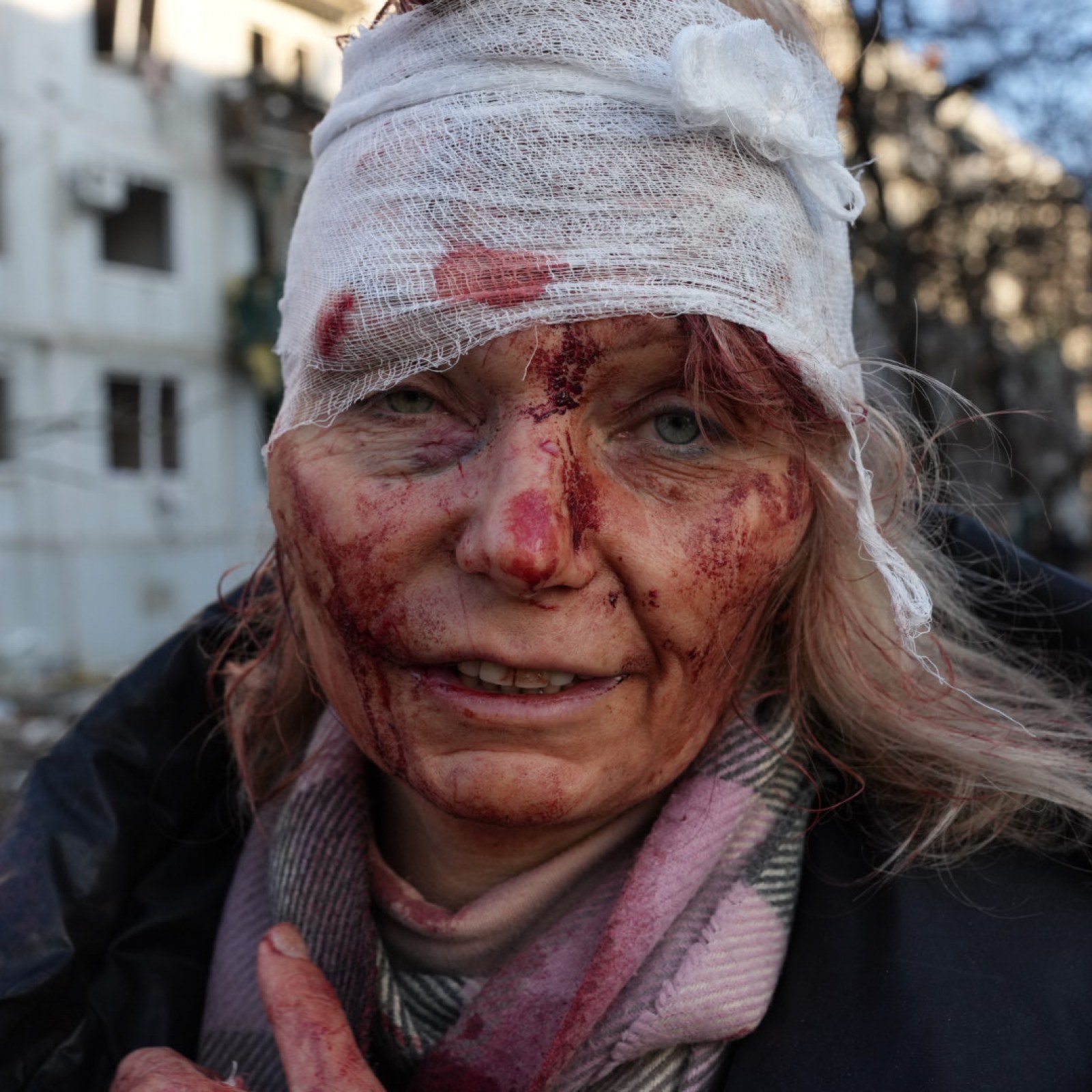 bloody ukrainian woman