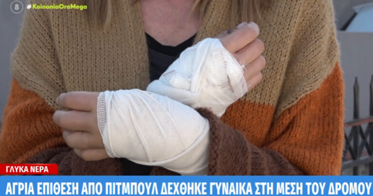 Γλυκά Νερά: Έβγαλε το σκύλο της βόλτα και δέχθηκε άγρια επίθεση από πίτμπουλ στη μέση του δρόμου