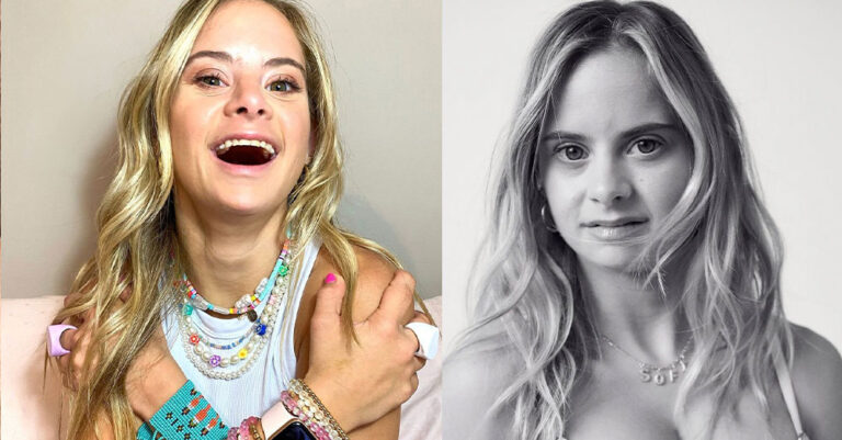 Το νέο μοντέλο της Victoria’s Secret είναι ένα υπέροχο κορίτσι με σύνδρομο Down